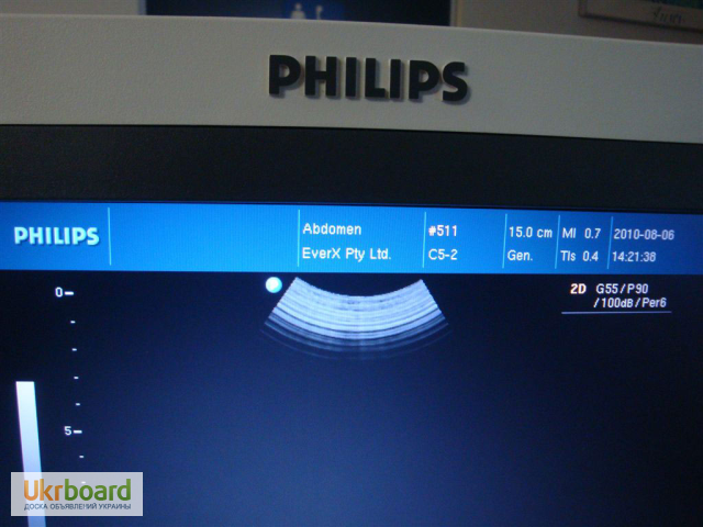 Фото 3. Ультразвуковой сканер Philips HD3