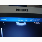 Ультразвуковой сканер Philips HD3