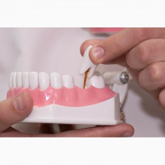 Имплантация зубов в Одессе по доступным ценам