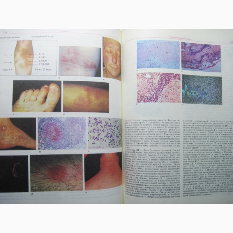 Фото 8. Ройт Основы иммунологии учебник 1991 Врожденный Специфический иммунитет Антиген