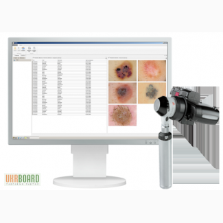 Цифровая дерматоскопия Vision Derma