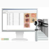 Цифровая дерматоскопия Vision Derma