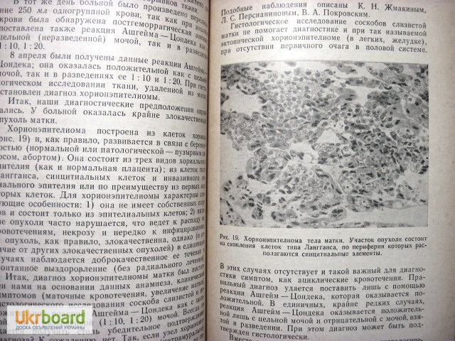 Фото 4. Жмакин Клинические лекции по гинекологии 1-е изд. 1966 Серия: Акушерство. Гинекология