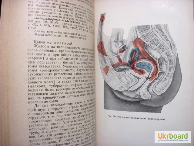 Фото 6. Жмакин Клинические лекции по гинекологии 1-е изд. 1966 Серия: Акушерство. Гинекология