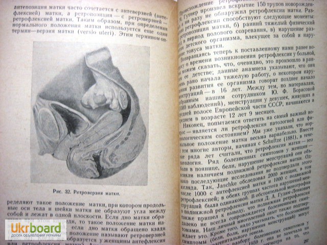 Фото 7. Жмакин Клинические лекции по гинекологии 1-е изд. 1966 Серия: Акушерство. Гинекология