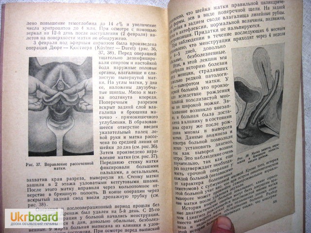 Фото 8. Жмакин Клинические лекции по гинекологии 1-е изд. 1966 Серия: Акушерство. Гинекология