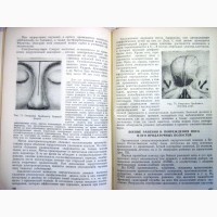 Компанеец Болезни носа и околоносовых пазух 1949 Пособие для студентов и врачей Гешелин