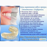 Капа, выравнивание зубов и прикуса. Cтоматология