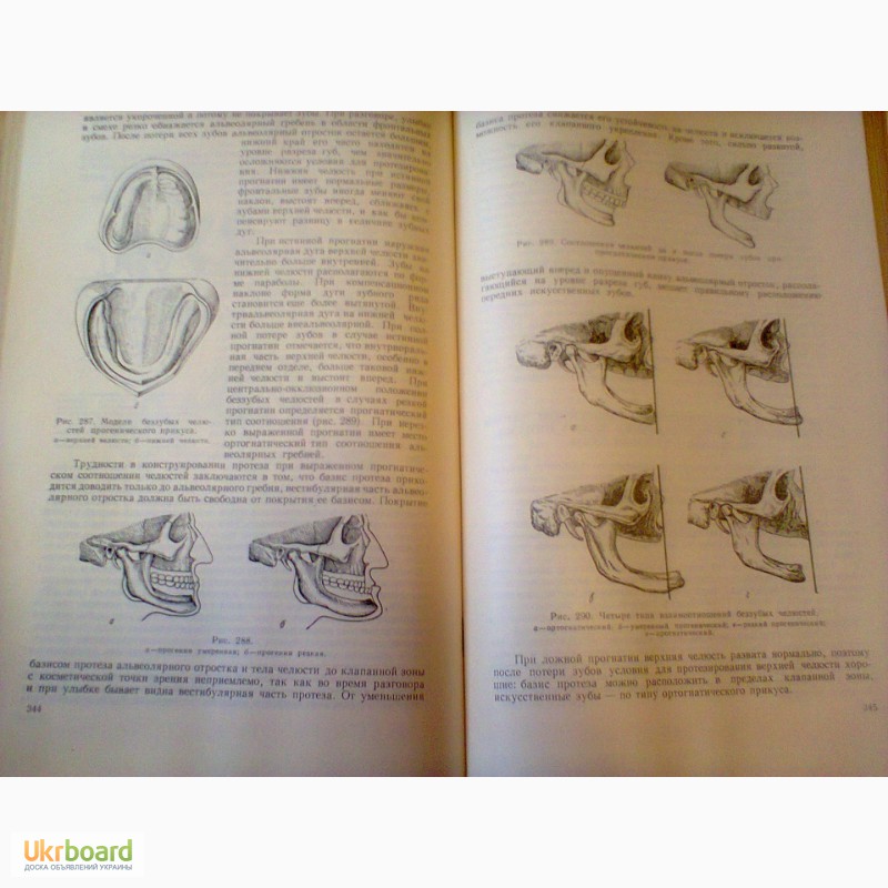 Фото 5. Учебник ортопедической стоматологии / Курляндский В. Ю