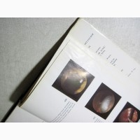 Лапароскопия в 2т Виттман Методика Инструменты Биопсия Патология органов брюшной полости