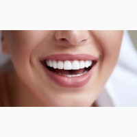 Профессиональное отбеливание зубов американским аппаратом Beyond в клинике Эстет Смайл Кие