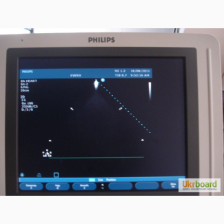 УЗИ аппарат Philips HD11XE экспертного класса
