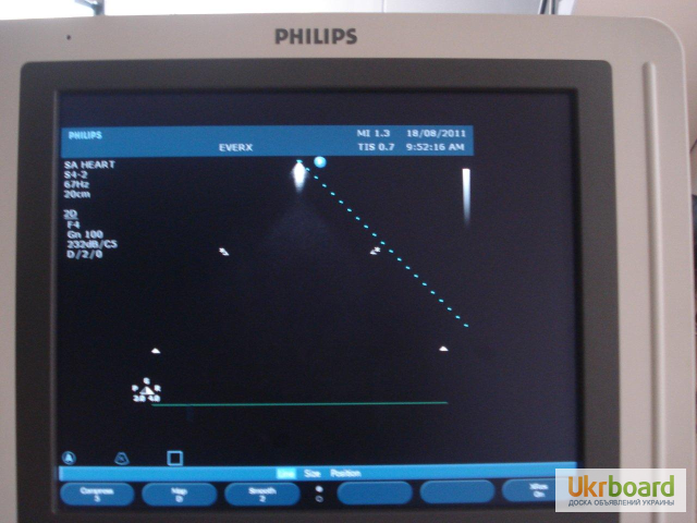 УЗИ аппарат Philips HD11XE экспертного класса