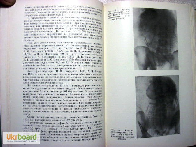 Фото 4. Демидкин Рентгенодиагностика в акушерстве 1969 Руководство для врачей. акушерская патологи