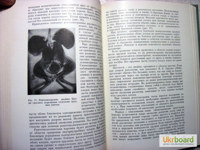 Фото 5. Демидкин Рентгенодиагностика в акушерстве 1969 Руководство для врачей. акушерская патологи