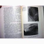 Демидкин Рентгенодиагностика в акушерстве 1969 Руководство для врачей. акушерская патологи