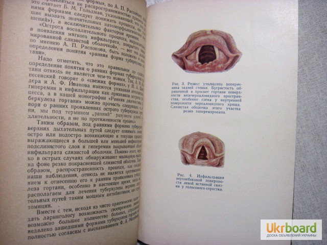 Фото 4. Распознавание ранних форм туберкулеза верхних дыхательных путей 1958 Добромыльский