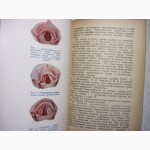 Распознавание ранних форм туберкулеза верхних дыхательных путей 1958 Добромыльский