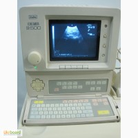 УЗИ Аппарат (Сканер) ALOKA SSD-500