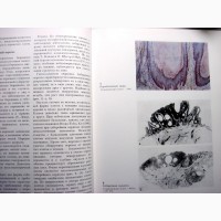 Атлас диагностических биопсий кожи 1973 Опухоли Новообразования Исследование Симпто Вихерт