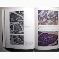 Атлас диагностических биопсий кожи 1973 Опухоли Новообразования Исследование Симпто Вихерт