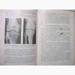 Внутрисуставные переломы Проф Вайнштейн 1959 особенности лечения застарелых травматических