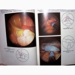 Эндоскопия в гинекологии Савельевой Методика диагностика рекомендации аппаратура лапароско