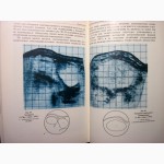 Эндоскопия в гинекологии Савельевой Методика диагностика рекомендации аппаратура лапароско