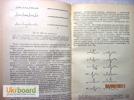 Фото 10. Абдуллаев Клинические лекции по актуальным вопросам кардиологии 1980 этиология патогенез к