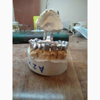 Зубной техник-керамист предлагает стоматологам сотрудничество