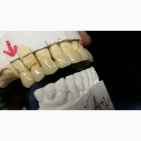 Зубной техник-керамист предлагает стоматологам сотрудничество