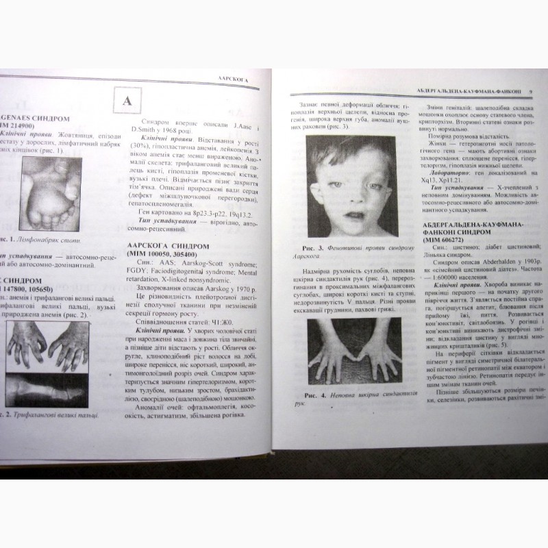 Фото 4. Спадкові синдроми з основами фенотипової діагностики 2010 словник-довідник Пішак Мислицьки