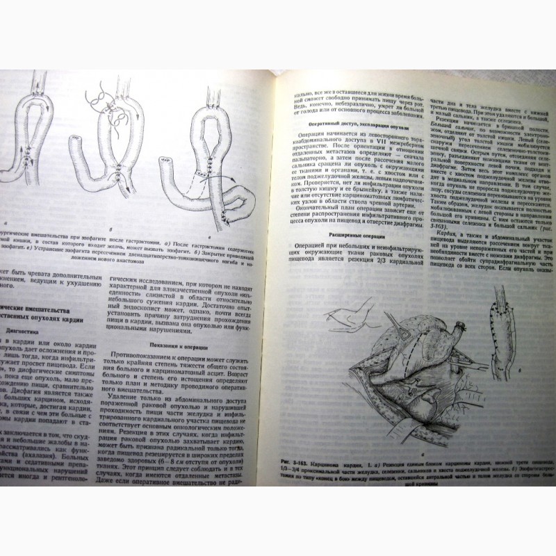 Фото 8. Оперативная хирургия Литтманн 1981 Методы Патологическая анатомия Детская хирургия Реанима